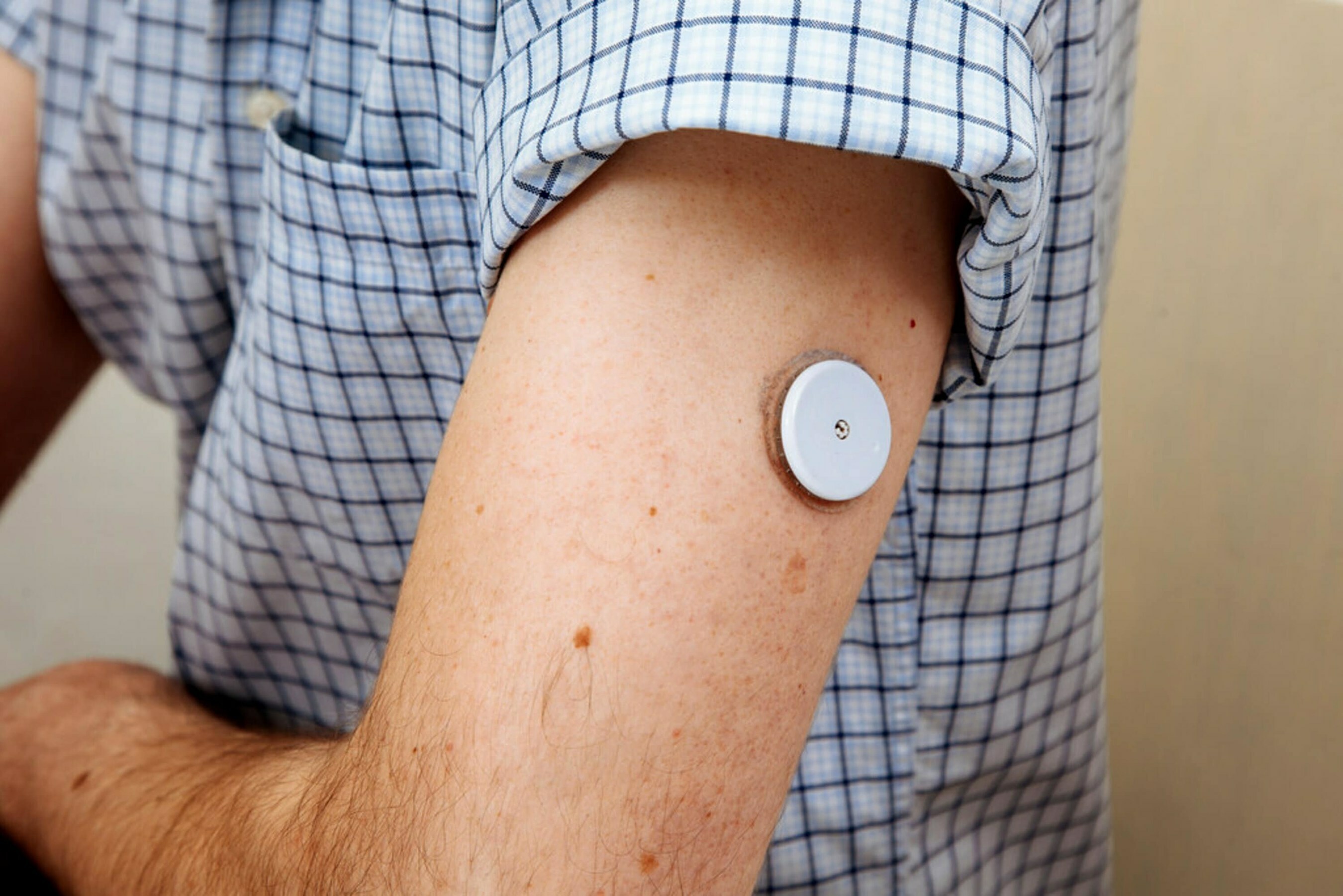 An arm with a rolled-up sleeve showcasing a small circular wearable medical device.